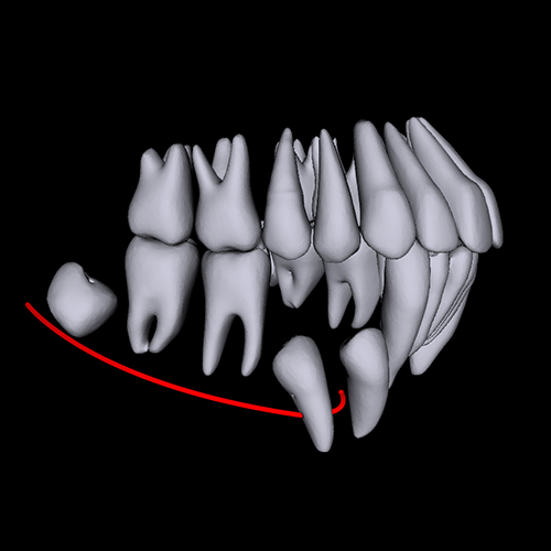 AI DRIVEN DENTAL SERVICE