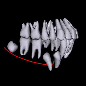 AI DRIVEN DENTAL SERVICE