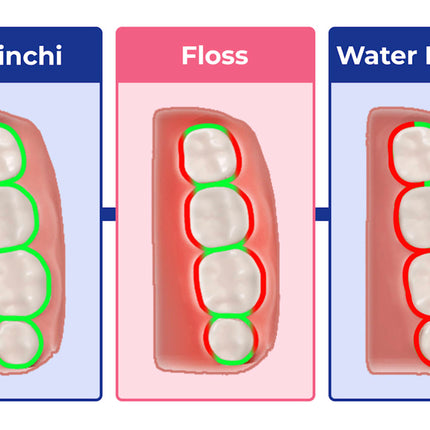 Devinchi Smart Dental Picks – Advanced Interdental Cleaning Tools for Plaque Removal & Gum Health