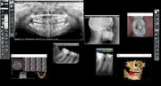 QUICKVISION – Dental Practice Management & Imaging Software