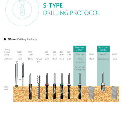 S-Type Implant