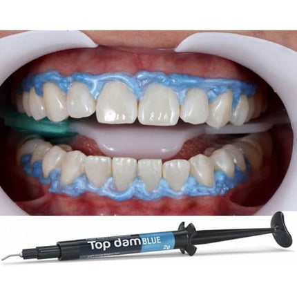 Top dam light-curing resin Gingival Dam, Blue, 1 x 2g Syringe & 3 applicator
