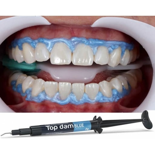 Top dam light-curing resin Gingival Dam, Blue, 1 x 2g Syringe & 3 applicator
