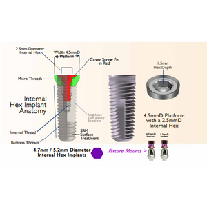 Yourdent-USA 5.2mm Diameter 4.5mm platform Slim pitch implant with cervical contoured mount. Made in USA from Grade 23 Titanium alloy compatible with major implants system Bio horizon, MIS, Zimmer and many others.